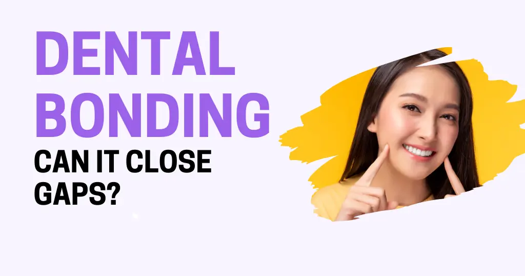 17389577175405-17389577134250-dental-bonding-gaps.webp no
