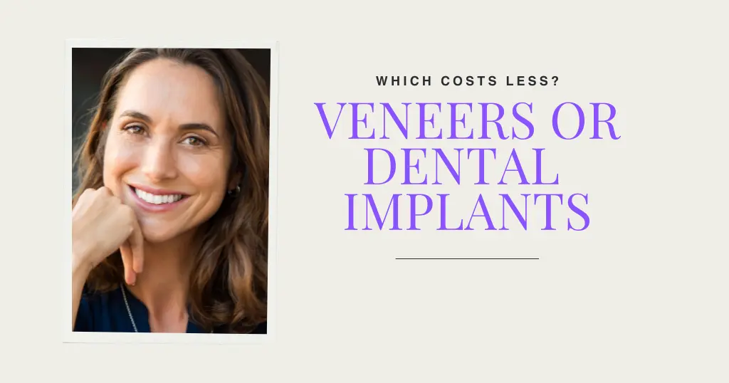 17389577183849-17389577136389-veneers-or-implants-cost.webp no