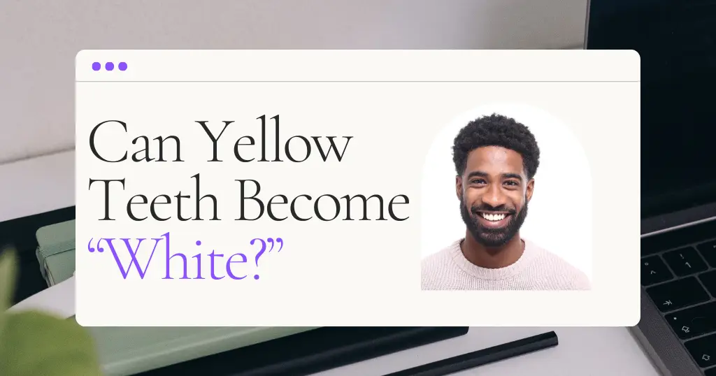 17389577184429-17389577136527-yellow-teeth-white.webp no