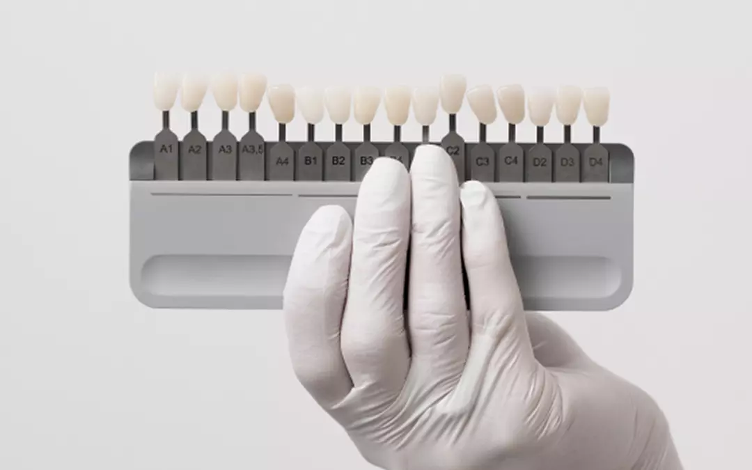 Dental Teeth Whitening Palette