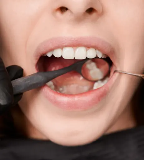 Dental Tools Exploring Patient Gums