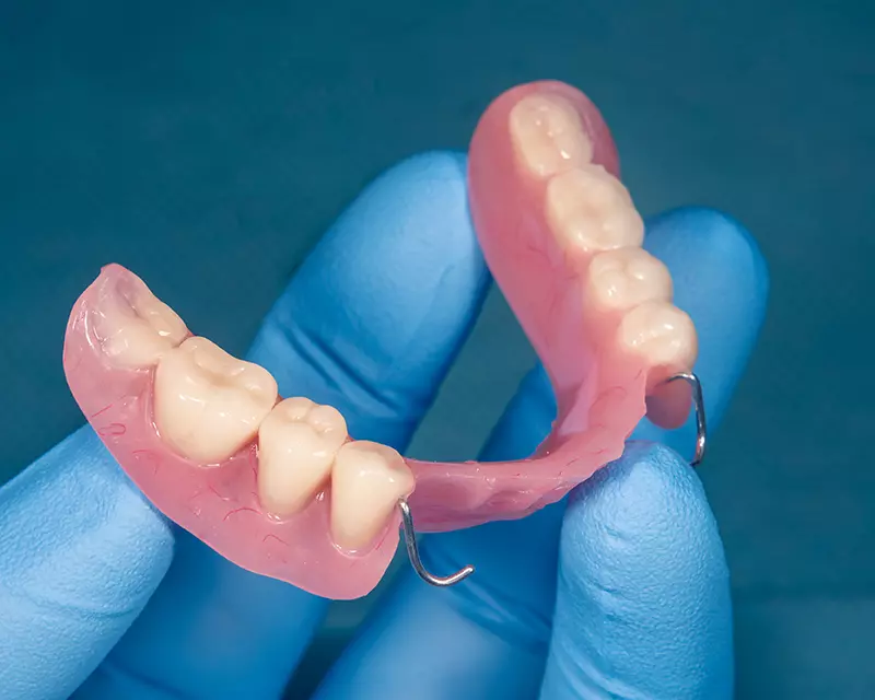 Partial Dentures
